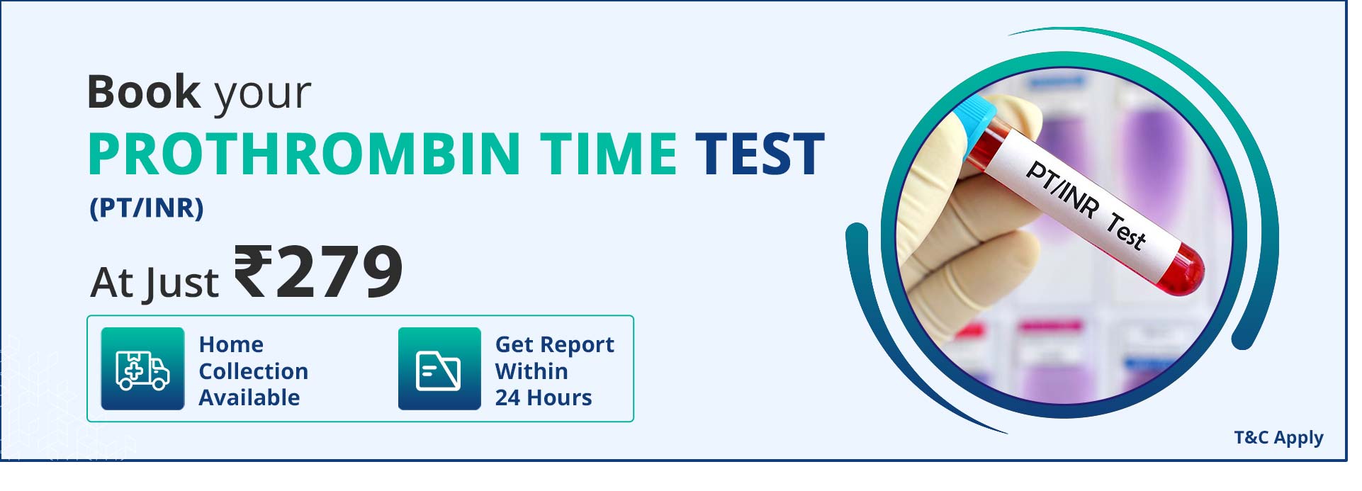 Prothrombin Time Test